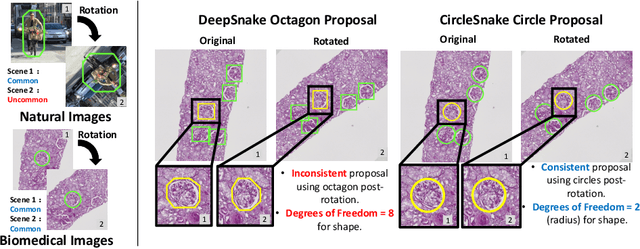 Figure 1 for CircleSnake: Instance Segmentation with Circle Representation