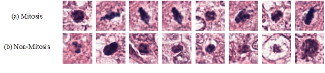 Figure 1 for A Novel Dataset and a Deep Learning Method for Mitosis Nuclei Segmentation and Classification