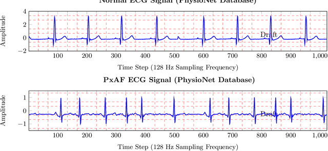 Figure 1 for Accurate Detection of Paroxysmal Atrial Fibrillation with Certified-GAN and Neural Architecture Search
