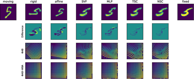 Figure 3 for Inverse Consistency by Construction for Multistep Deep Registration