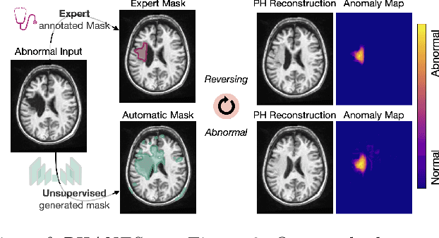 Figure 1 for Reversing the Abnormal: Pseudo-Healthy Generative Networks for Anomaly Detection