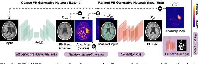 Figure 3 for Reversing the Abnormal: Pseudo-Healthy Generative Networks for Anomaly Detection