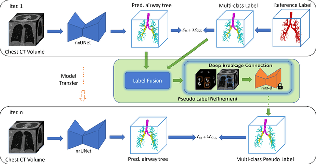 Figure 2 for Accurate Airway Tree Segmentation in CT Scans via Anatomy-aware Multi-class Segmentation and Topology-guided Iterative Learning