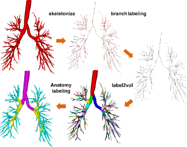 Figure 3 for Accurate Airway Tree Segmentation in CT Scans via Anatomy-aware Multi-class Segmentation and Topology-guided Iterative Learning