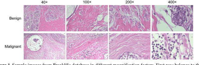 Figure 1 for Reduced Deep Convolutional Activation Features (R-DeCAF) in Histopathology Images to Improve the Classification Performance for Breast Cancer Diagnosis