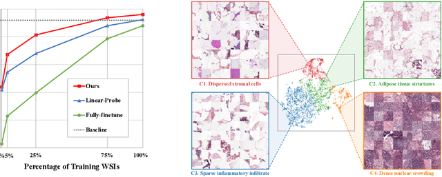 Figure 4 for Prompt-Guided Adaptive Model Transformation for Whole Slide Image Classification