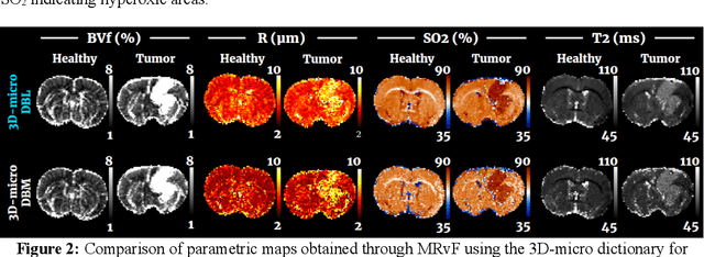 Figure 2 for Enhancing MR vascular Fingerprinting through realistic microvascular geometries