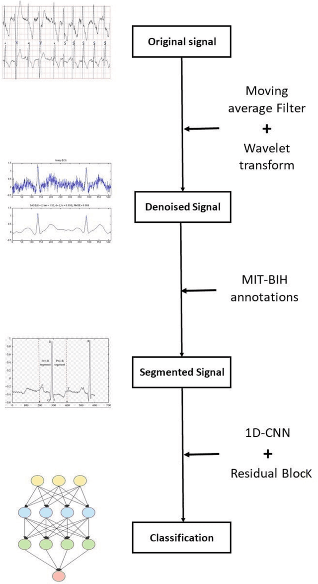 Figure 1 for ECG Classification System for Arrhythmia Detection Using Convolutional Neural Networks