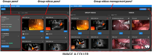 Figure 2 for INDEXITY: a web-based collaborative tool for medical video annotation