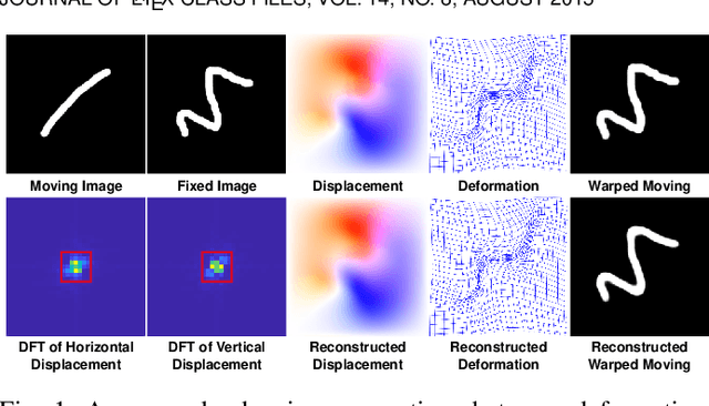 Figure 1 for Fourier-Net+: Leveraging Band-Limited Representation for Efficient 3D Medical Image Registration