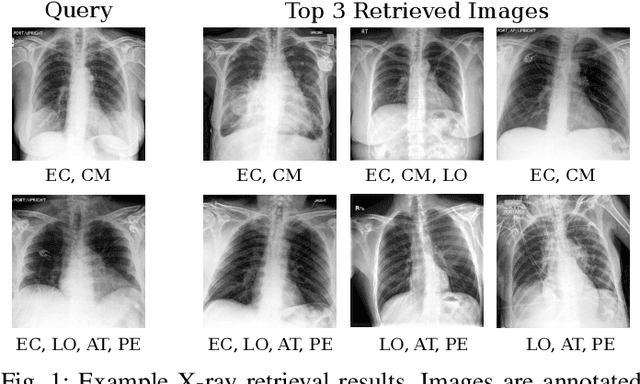 Figure 1 for Multimorbidity Content-Based Medical Image Retrieval Using Proxies