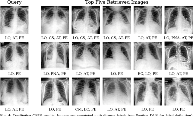 Figure 4 for Multimorbidity Content-Based Medical Image Retrieval Using Proxies