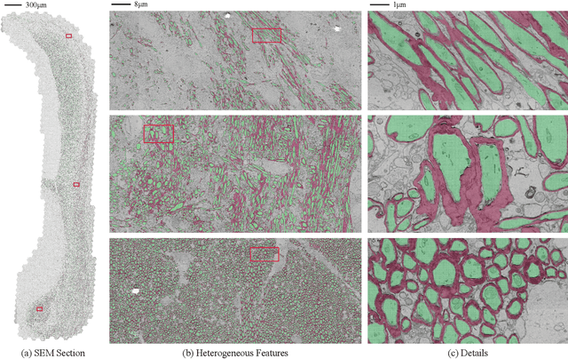Figure 1 for AxonCallosumEM Dataset: Axon Semantic Segmentation of Whole Corpus Callosum cross section from EM Images