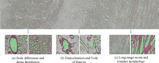 Figure 3 for AxonCallosumEM Dataset: Axon Semantic Segmentation of Whole Corpus Callosum cross section from EM Images