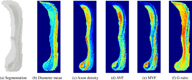 Figure 4 for AxonCallosumEM Dataset: Axon Semantic Segmentation of Whole Corpus Callosum cross section from EM Images