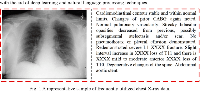 Figure 1 for Dynamic Multi-Domain Knowledge Networks for Chest X-ray Report Generation