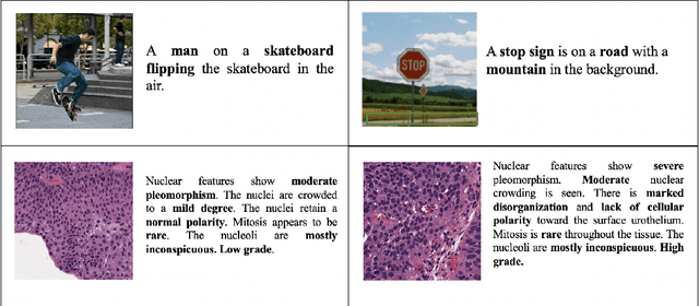 Figure 1 for GNNFormer: A Graph-based Framework for Cytopathology Report Generation