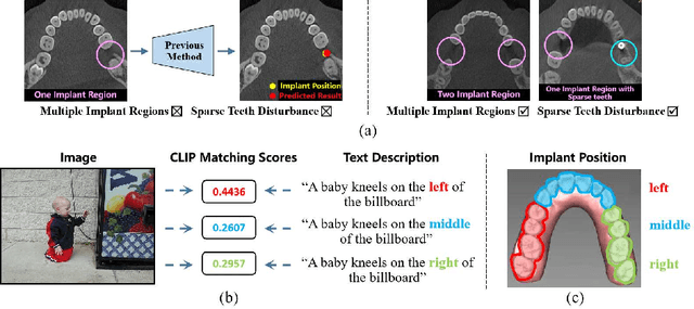Figure 1 for TCEIP: Text Condition Embedded Regression Network for Dental Implant Position Prediction