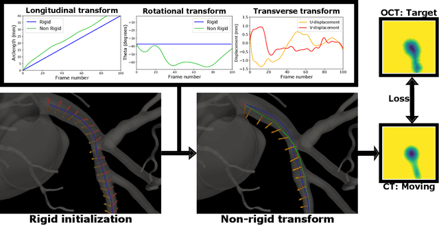 Figure 4 for Morphology-based non-rigid registration of coronary computed tomography and intravascular images through virtual catheter path optimization