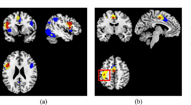 Figure 4 for Chat2Brain: A Method for Mapping Open-Ended Semantic Queries to Brain Activation Maps