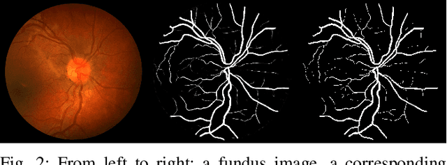 Figure 2 for Overview of Deep Learning Methods for Retinal Vessel Segmentation