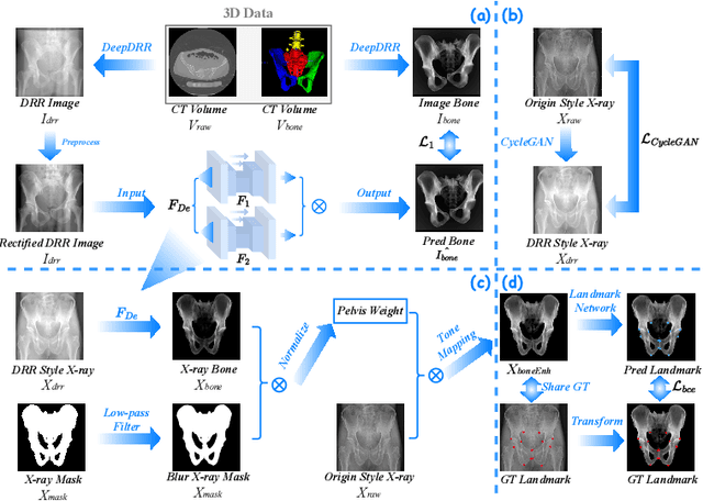 Figure 3 for PELE scores: Pelvic X-ray Landmark Detection by Pelvis Extraction and Enhancement