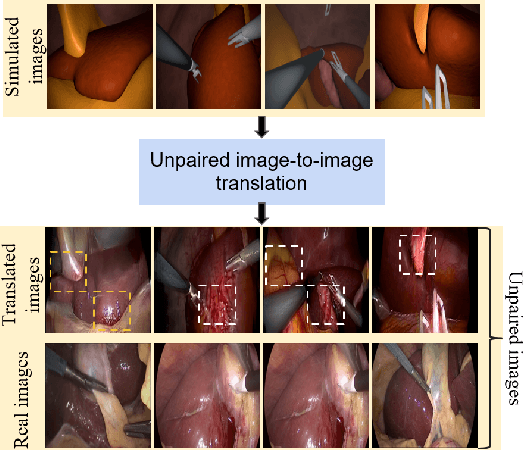 Figure 1 for Exploring Semantic Consistency in Unpaired Image Translation to Generate Data for Surgical Applications