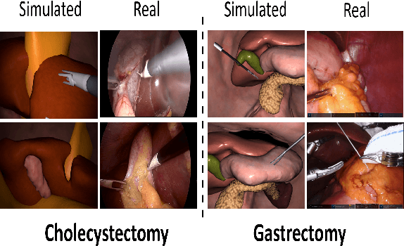 Figure 3 for Exploring Semantic Consistency in Unpaired Image Translation to Generate Data for Surgical Applications