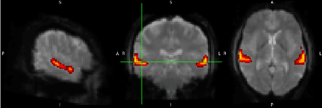 Figure 3 for Self-Supervised Pretraining on Paired Sequences of fMRI Data for Transfer Learning to Brain Decoding Tasks