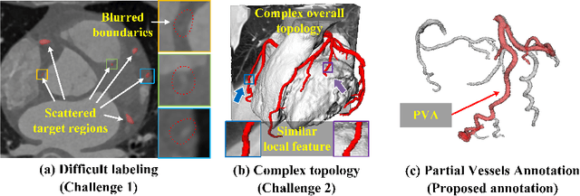 Figure 1 for Partial Vessels Annotation-based Coronary Artery Segmentation with Self-training and Prototype Learning