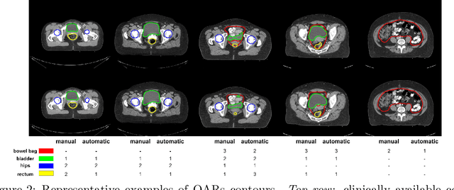 Figure 3 for Clinically Acceptable Segmentation of Organs at Risk in Cervical Cancer Radiation Treatment from Clinically Available Annotations