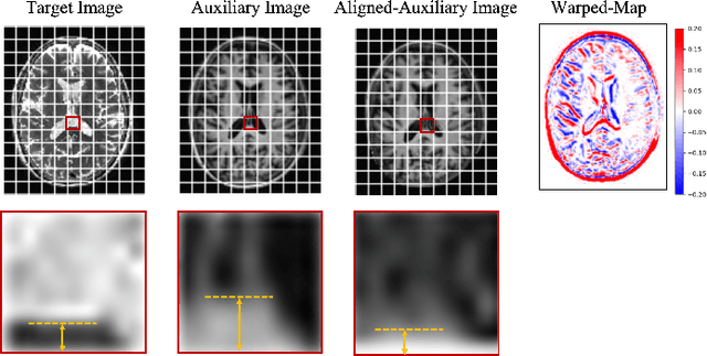 Figure 1 for Spatial and Modal Optimal Transport for Fast Cross-Modal MRI Reconstruction