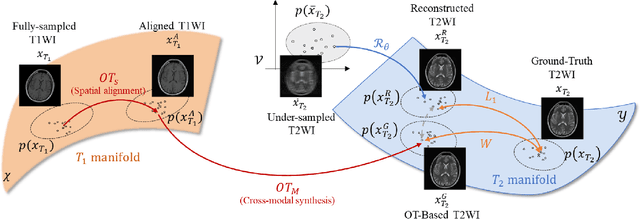 Figure 3 for Spatial and Modal Optimal Transport for Fast Cross-Modal MRI Reconstruction