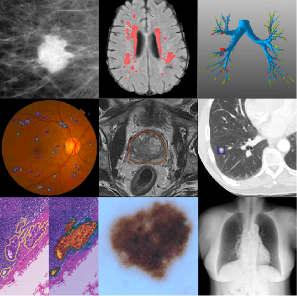 Figure 3 for Medical Image Analysis using Deep Relational Learning