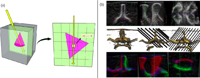 Figure 1 for Ultra-NeRF: Neural Radiance Fields for Ultrasound Imaging