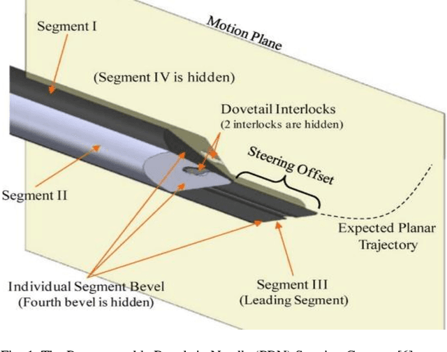 Figure 1 for Towards a Procedure Optimised Steerable Microcatheter for Deep Seated Neurosurgery