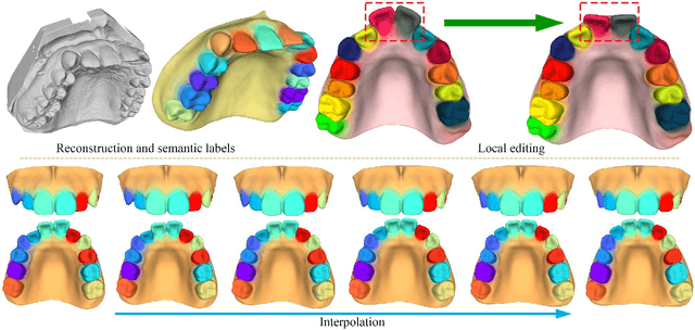 Figure 1 for An Implicit Parametric Morphable Dental Model