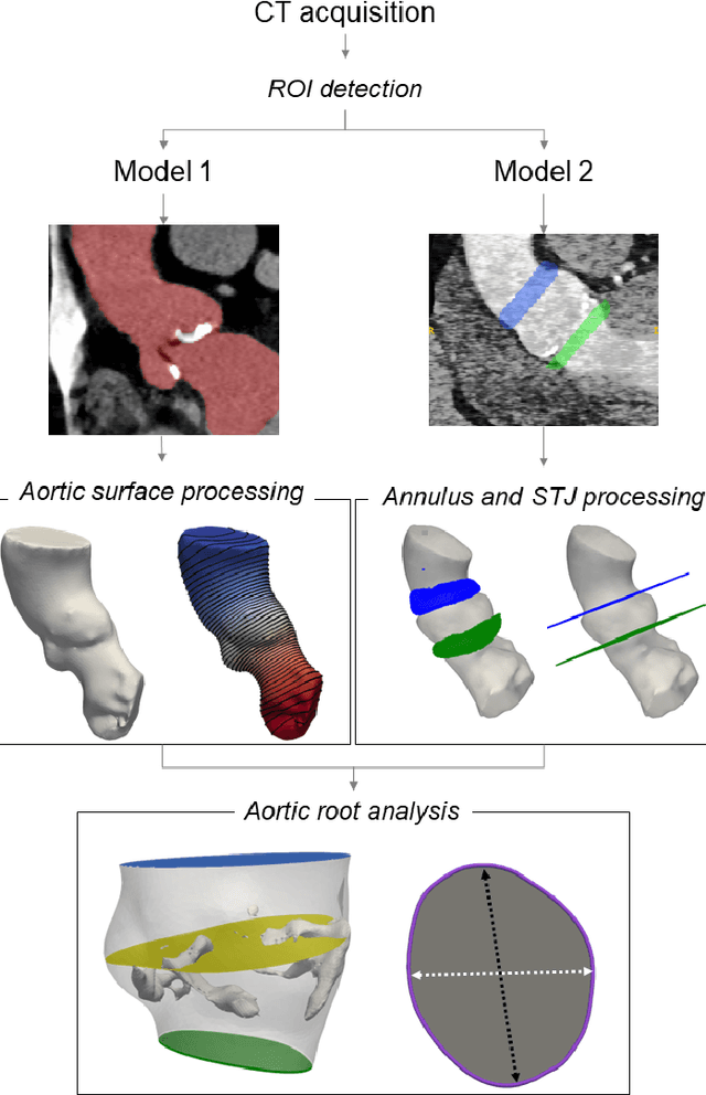 Figure 2 for A CT-based deep learning system for automatic assessment of aortic root morphology for TAVI planning