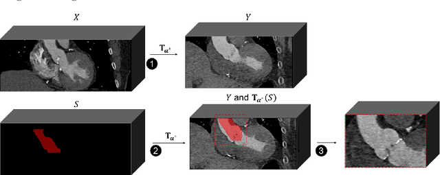 Figure 3 for A CT-based deep learning system for automatic assessment of aortic root morphology for TAVI planning