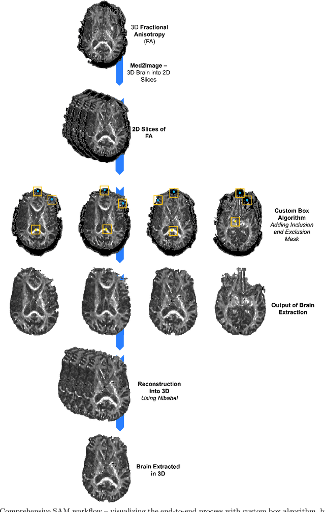 Figure 1 for SAM vs BET: A Comparative Study for Brain Extraction and Segmentation of Magnetic Resonance Images using Deep Learning