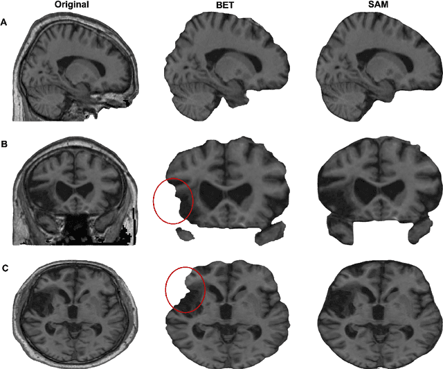 Figure 3 for SAM vs BET: A Comparative Study for Brain Extraction and Segmentation of Magnetic Resonance Images using Deep Learning