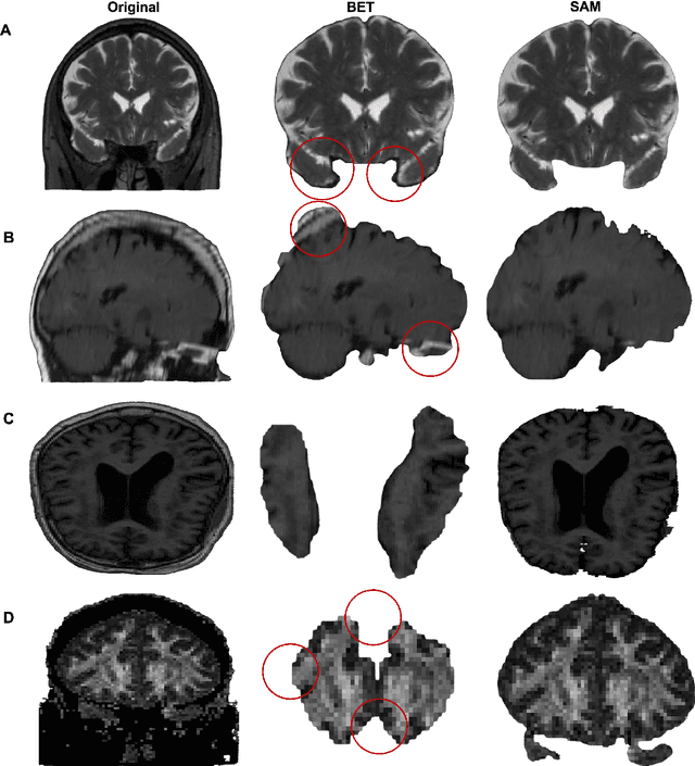 Figure 4 for SAM vs BET: A Comparative Study for Brain Extraction and Segmentation of Magnetic Resonance Images using Deep Learning