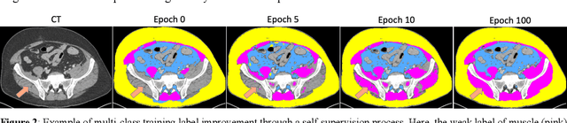 Figure 3 for Self and Mixed Supervision to Improve Training Labels for Multi-Class Medical Image Segmentation
