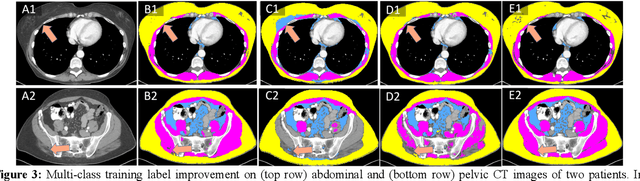 Figure 4 for Self and Mixed Supervision to Improve Training Labels for Multi-Class Medical Image Segmentation