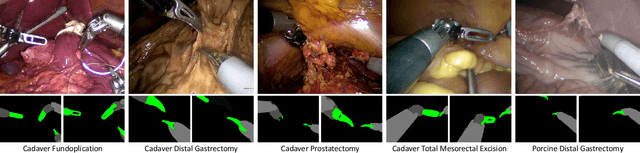 Figure 3 for Visual-Kinematics Graph Learning for Procedure-agnostic Instrument Tip Segmentation in Robotic Surgeries