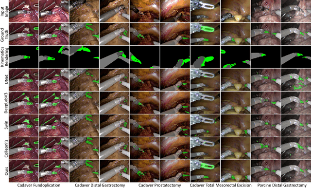 Figure 4 for Visual-Kinematics Graph Learning for Procedure-agnostic Instrument Tip Segmentation in Robotic Surgeries