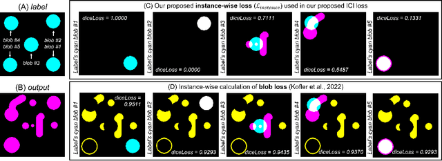 Figure 1 for Improving Segmentation of Objects with Varying Sizes in Biomedical Images using Instance-wise and Center-of-Instance Segmentation Loss Function