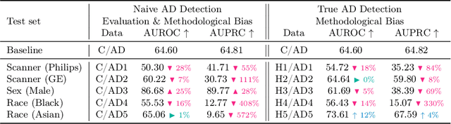 Figure 3 for Bias in Unsupervised Anomaly Detection in Brain MRI