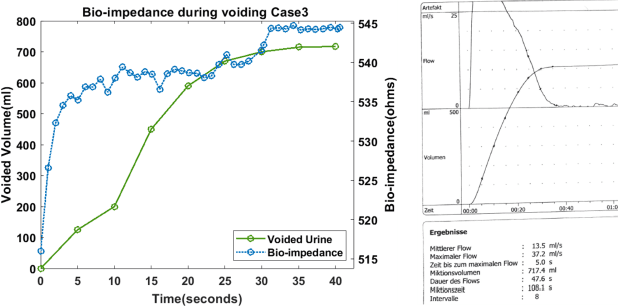 Figure 1 for Non-invasive urinary bladder volume estimation with artefact-suppressed bio-impedance measurements