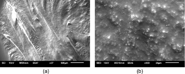 Figure 3 for Multi-Modal Wireless Flexible Gel-Free Sensors with Edge Deep Learning for Detecting and Alerting Freezing of Gait in Parkinson's Patients